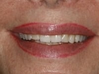 Konig Center for Cosmetic & Comprehensive Dentistry smile photos